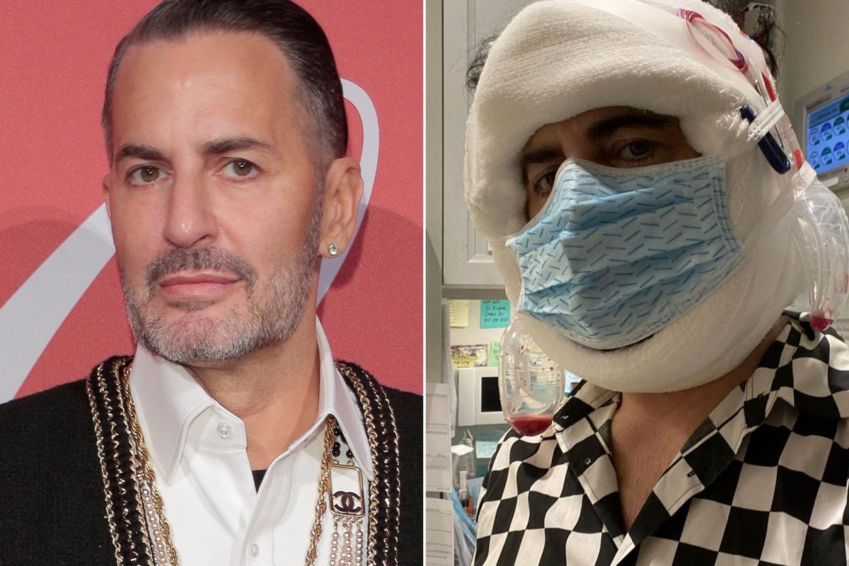 Marc Jacobs Isn’t Hiding His Facelift