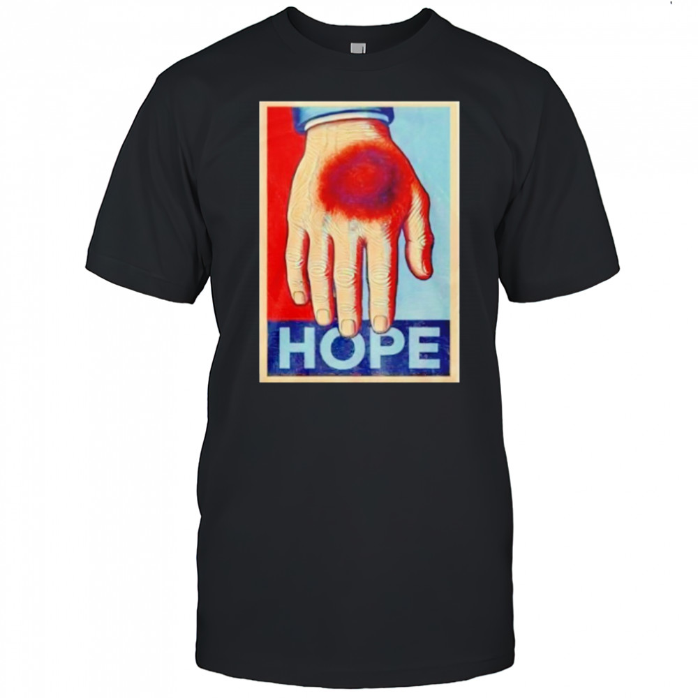 Donald Trump bruise hand hope shirt