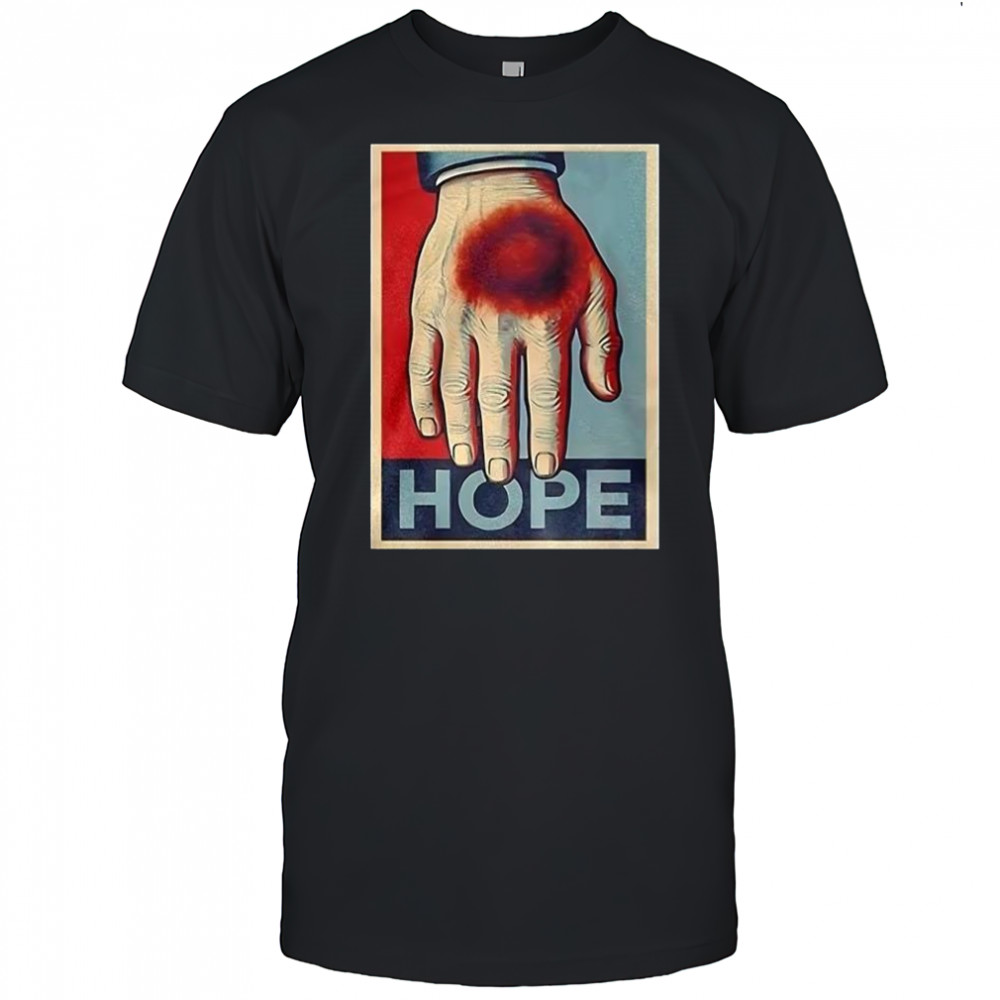 Donald Trump bruise hand Hope shirt